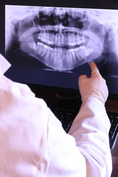 Best Emergency Dentist for Knocked-Out Tooth in Splendora, TX