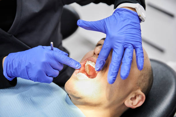 Best Emergency Dentist for Lost Fillings or Crowns in Splendora, TX